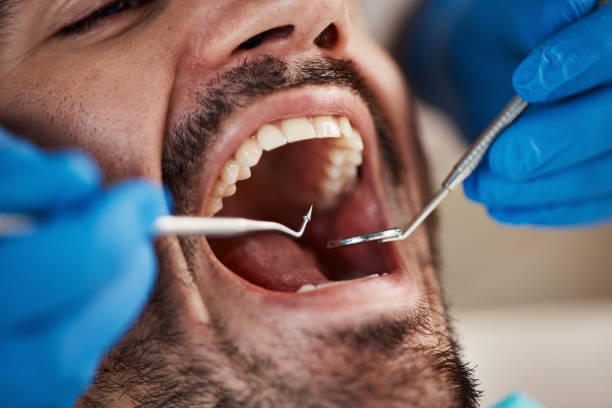 Best Broken or Chipped Tooth Repair in Valdese, NC