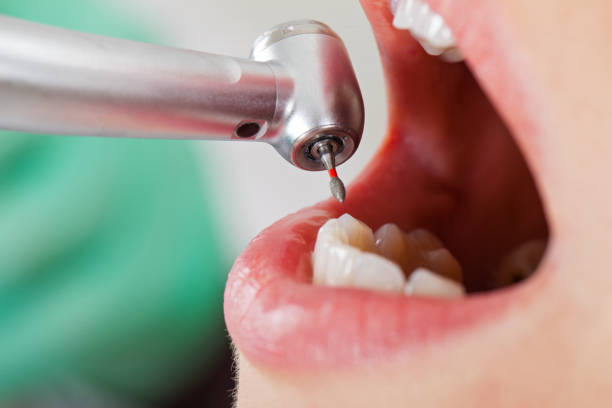 Best Emergency Denture Repair in Valdese, NC